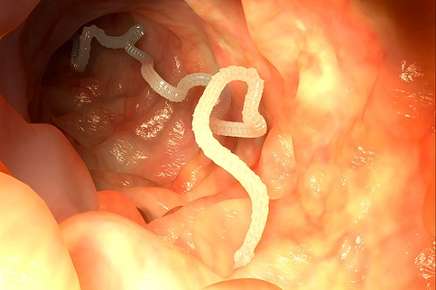 Tapeworms